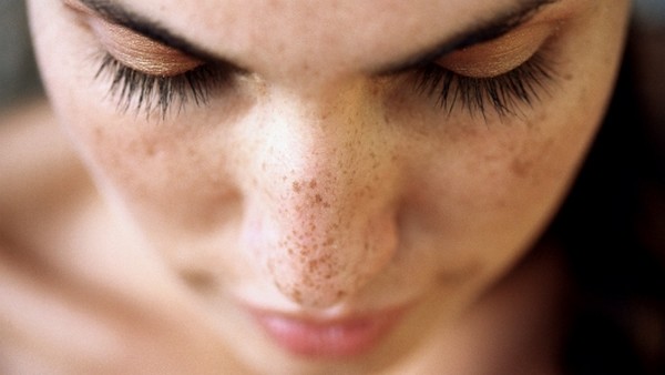 Beberapa upaya bisa dilakukan untuk menghilangkan flek hitam.(Foto: PerfectBeuaty.id) Beberapa upaya bisa dilakukan untuk menghilangkan flek hitam.(Foto: PerfectBeuaty.id)