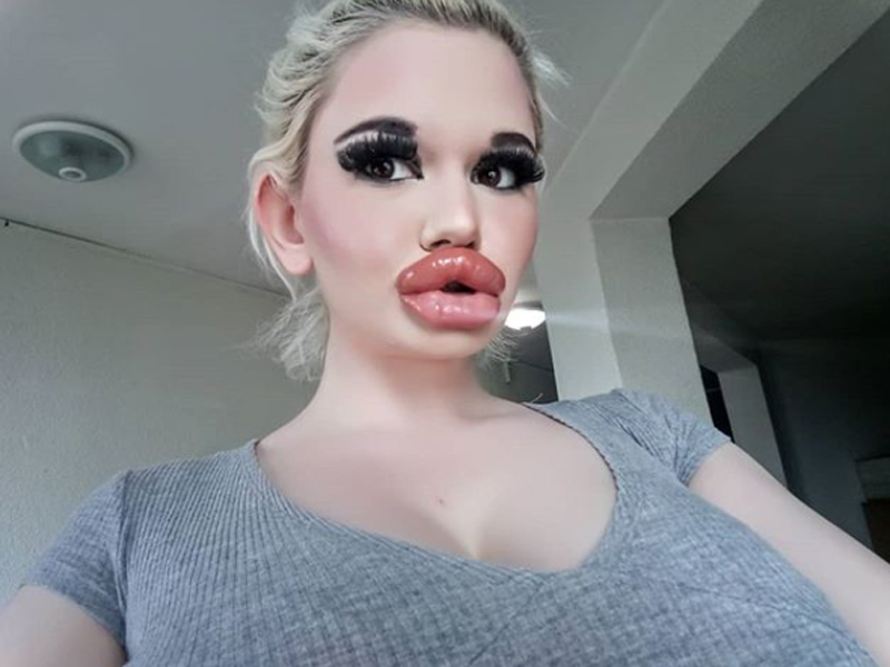 Andrea Ivanova ingin mempunyai bibir terbesar di dunia. Foto: Instagram/andrea.andrea345 Andrea Ivanova ingin mempunyai bibir terbesar di dunia. Foto: Instagram/andrea.andrea345