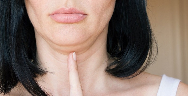 ilustrasi: cara mengilangkan double chin (Foto : women best ) ilustrasi: cara mengilangkan double chin (Foto : women best )
