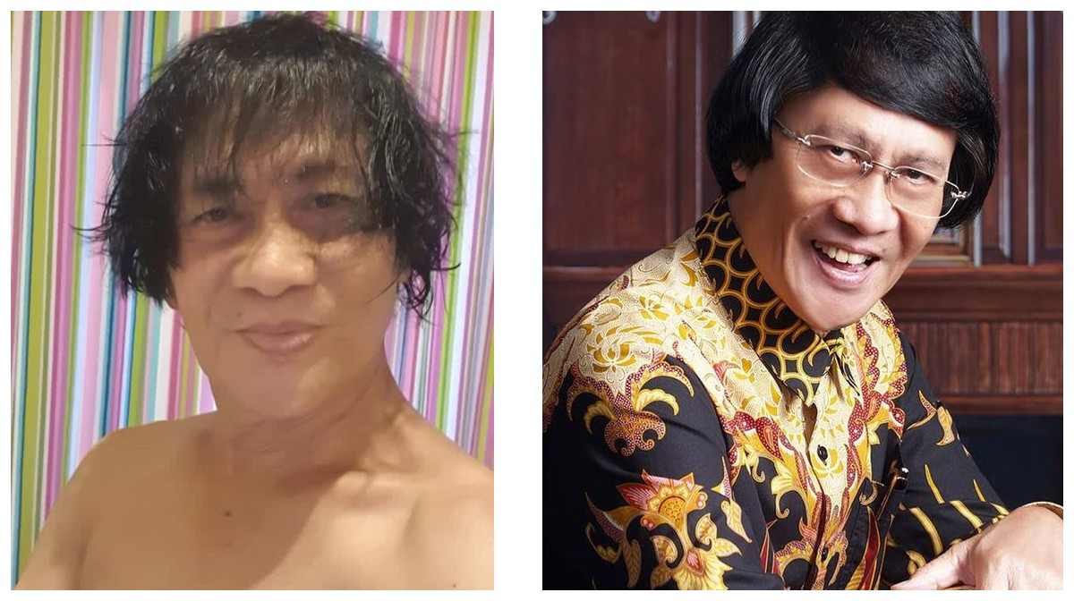 Rambut Kak Seto: Foto: IG @kaksetosahabatanak Rambut Kak Seto: Foto: IG @kaksetosahabatanak