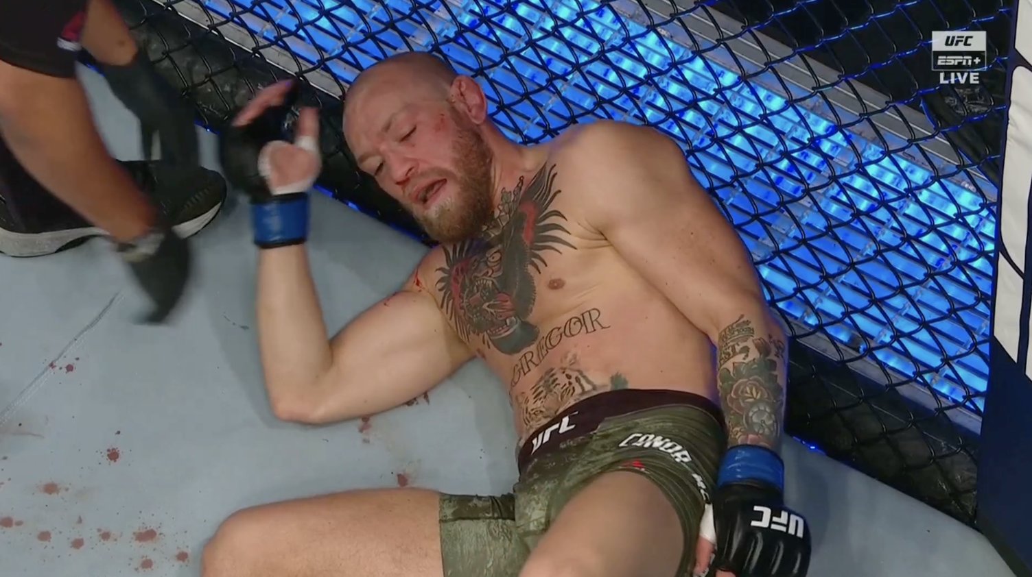 Wajah Conor McGregor usai ditaklukkan Dustin Poirier. (foto: twitter.com/BleacherReport) Wajah Conor McGregor usai ditaklukkan Dustin Poirier. (foto: twitter.com/BleacherReport)