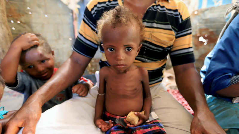 Ilustrasi-Kelaparan.Foto: Reuters. Ilustrasi-Kelaparan.Foto: Reuters.
