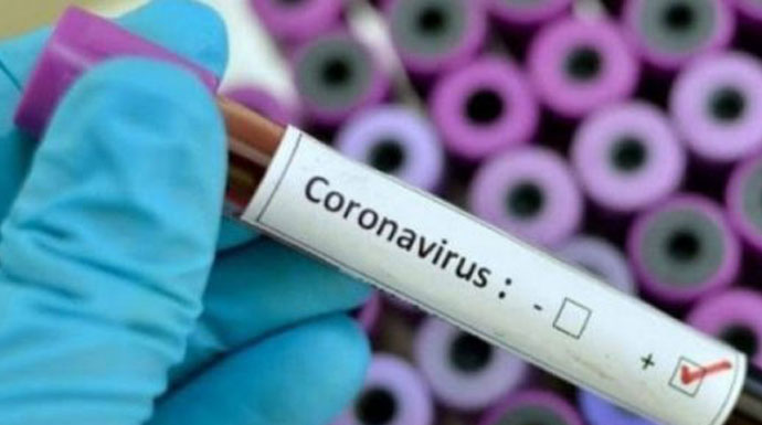 Hadapi Gelombang Kedua Virus Corona, Negara Ini Kapok Lockdown - ilustrasi (Foto: Freepik) Hadapi Gelombang Kedua Virus Corona, Negara Ini Kapok Lockdown - ilustrasi (Foto: Freepik)