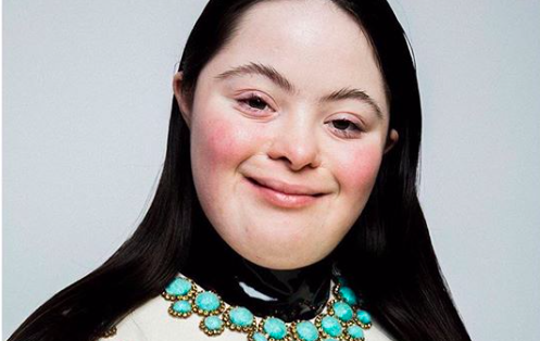 Ellie Goldstein, remaja down syndrome yang jadi model Gucci Beauty. Foto: IG @elliejg16_zebedeemodel Ellie Goldstein, remaja down syndrome yang jadi model Gucci Beauty. Foto: IG @elliejg16_zebedeemodel