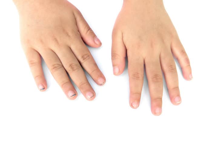 Foto: Shutterstock Foto: Shutterstock