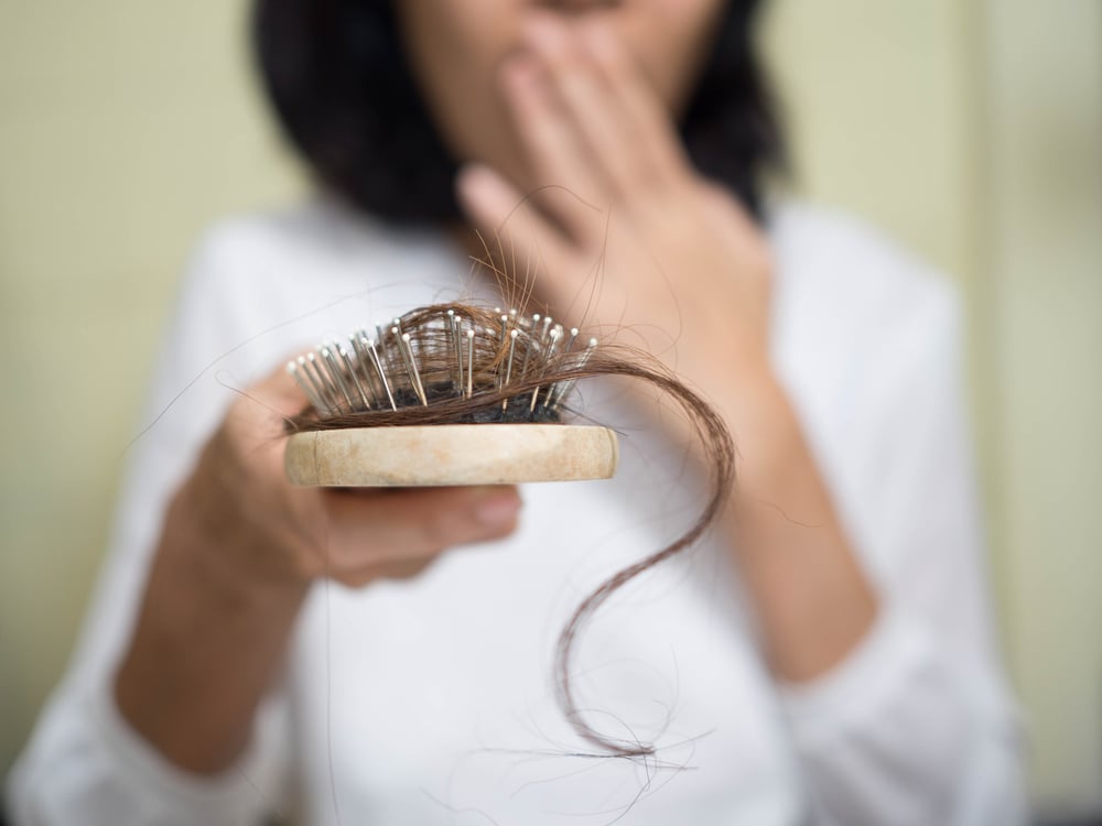 Ilustrasi rambut rontok. Foto: Shutterstock Ilustrasi rambut rontok. Foto: Shutterstock
