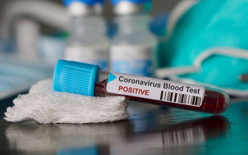 Ilustrasi sample darah yang terindikasi positif virus corona - Antara/Shutterstock Ilustrasi sample darah yang terindikasi positif virus corona - Antara/Shutterstock
