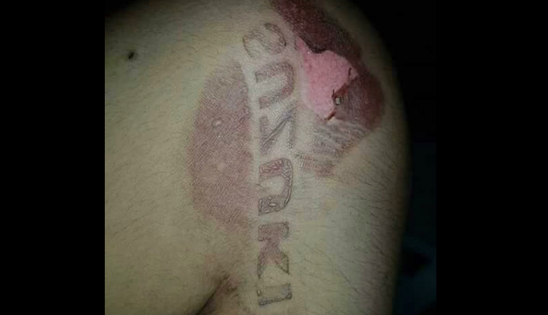 Beginilah definisi nyata luka tak seberapa dibanding malunya! (Foto : Twitter @Lehugaaa) Beginilah definisi nyata luka tak seberapa dibanding malunya! (Foto : Twitter @Lehugaaa)