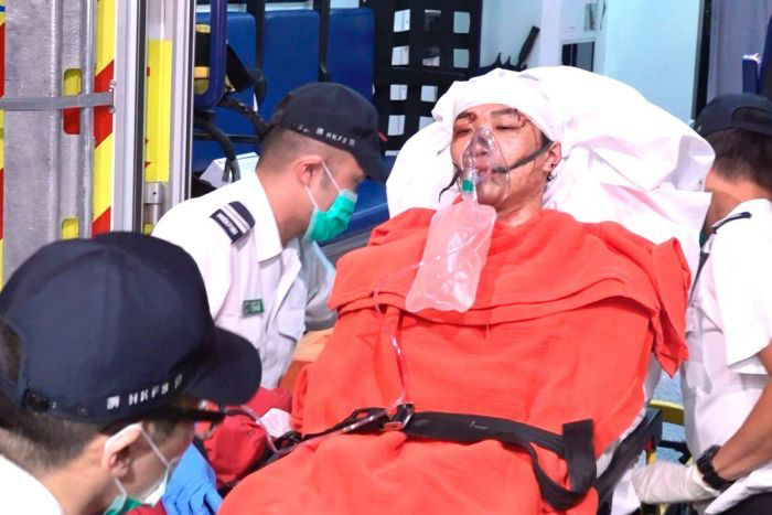 Aktivis pro-demokrasi Hong Kong diserang hingga kepalanya bocor. Dia kini dirawat di rumah sakit (Foto : ABC News) Aktivis pro-demokrasi Hong Kong diserang hingga kepalanya bocor. Dia kini dirawat di rumah sakit (Foto : ABC News)