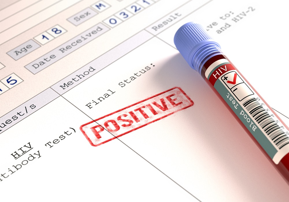 Ada beberapa kesalapahaman seputar penularan virus HIV/AIDS. (Foto: Elements Envato) Ada beberapa kesalapahaman seputar penularan virus HIV/AIDS. (Foto: Elements Envato)