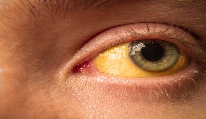 Ilustras mata kuning. (access eye) Ilustras mata kuning. (access eye)