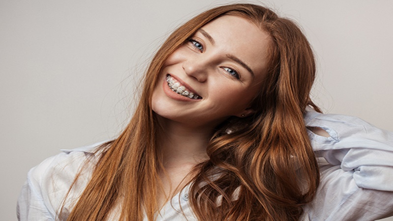 Ilustrasi (foto: Evolution orthodontics) Ilustrasi (foto: Evolution orthodontics)
