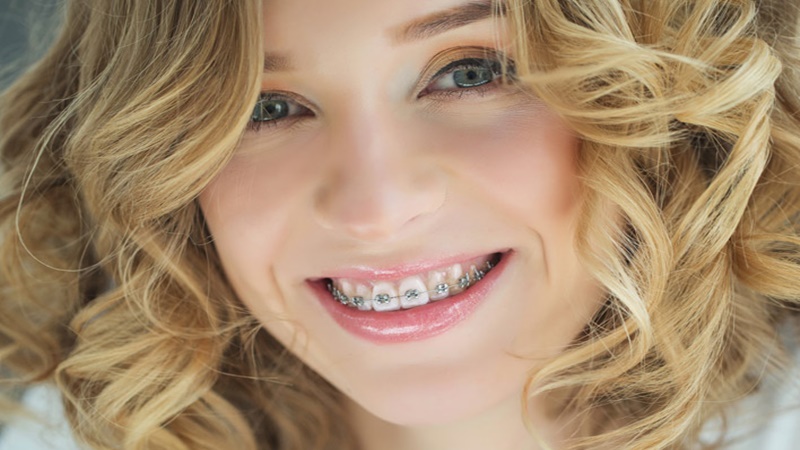 Ilustrasi (foto: nrh orthodontics) Ilustrasi (foto: nrh orthodontics)