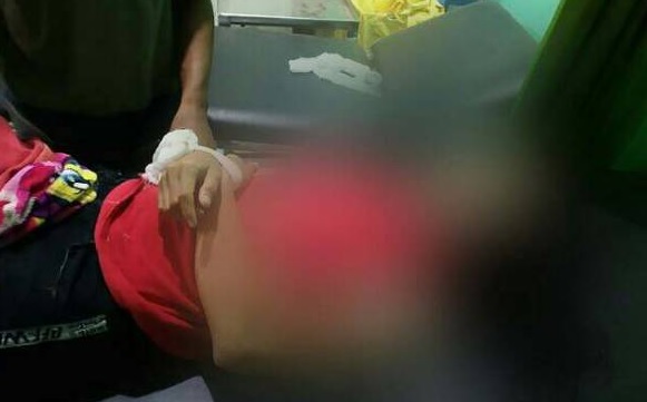 Biduan organ tunggal Sari, 23, tewas dikeroyok dan dilempari batu oleh orang tak dikenal. Foto: sumeks.co Biduan organ tunggal Sari, 23, tewas dikeroyok dan dilempari batu oleh orang tak dikenal. Foto: sumeks.co