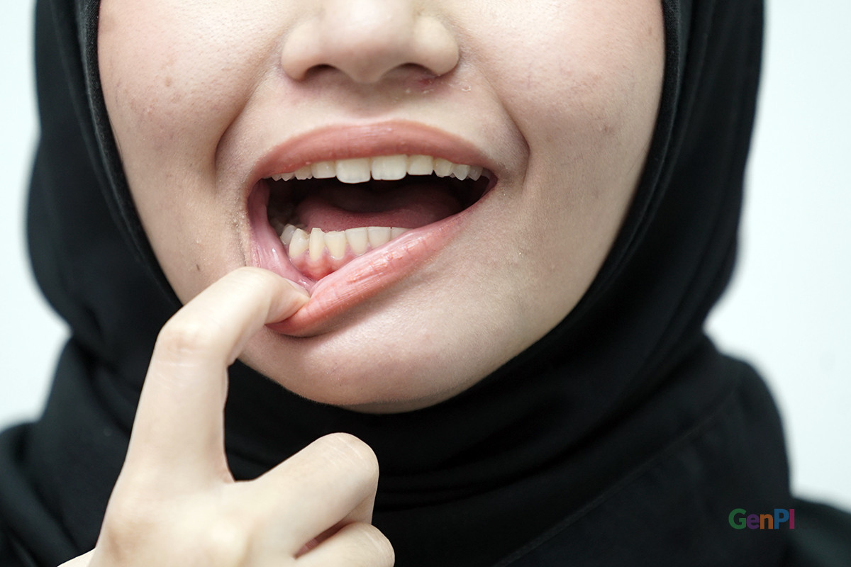 Oral Cancer lurks, these are 6 powerful ways